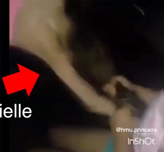 美国网红13岁成名,21岁患癌!抗癌期竟还整容?网友:要美不要命