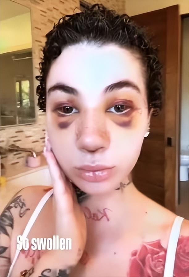 美国网红13岁成名,21岁患癌!抗癌期竟还整容?网友:要美不要命