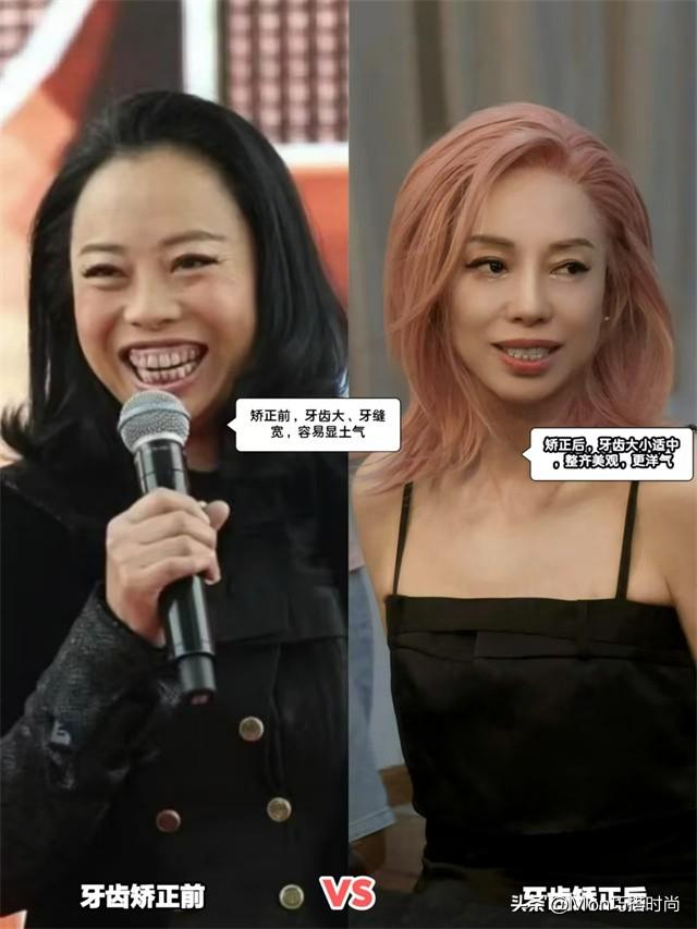 一个女人好不好看,看她的“牙齿”就知道了,差别不是一般的大