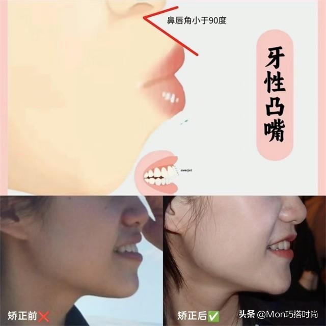 一个女人好不好看,看她的“牙齿”就知道了,差别不是一般的大