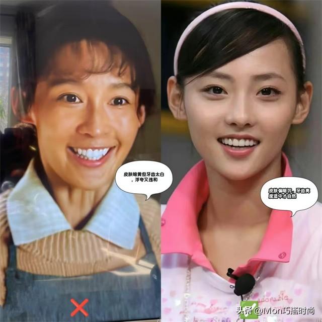 一个女人好不好看,看她的“牙齿”就知道了,差别不是一般的大