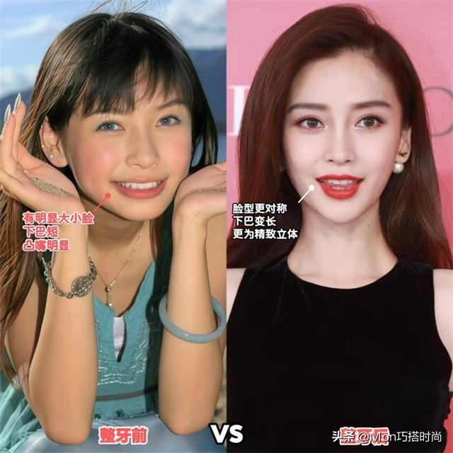 一个女人好不好看,看她的“牙齿”就知道了,差别不是一般的大