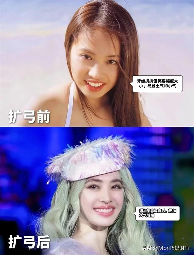 一个女人好不好看,看她的“牙齿”就知道了,差别不是一般的大