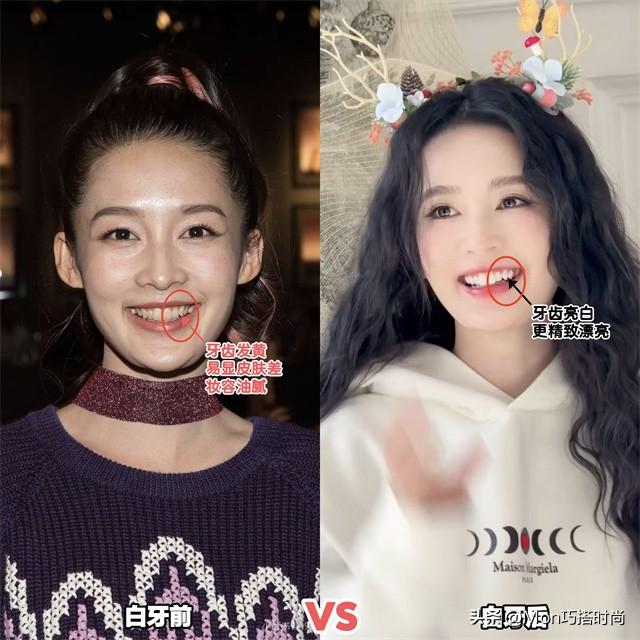 一个女人好不好看,看她的“牙齿”就知道了,差别不是一般的大