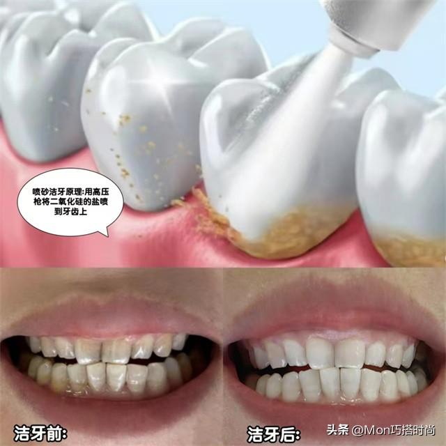 一个女人好不好看,看她的“牙齿”就知道了,差别不是一般的大