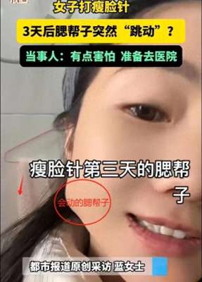口动美女图片(打瘦脸针获“腮帮舞”新技能？女子经历引热议)