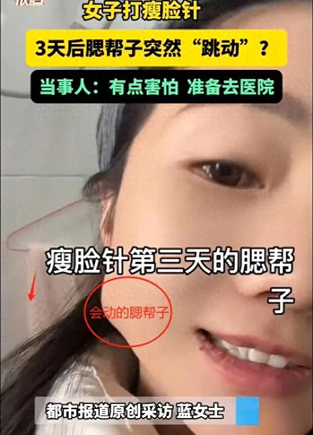 打瘦脸针获“腮帮舞”新技能?女子经历引热议