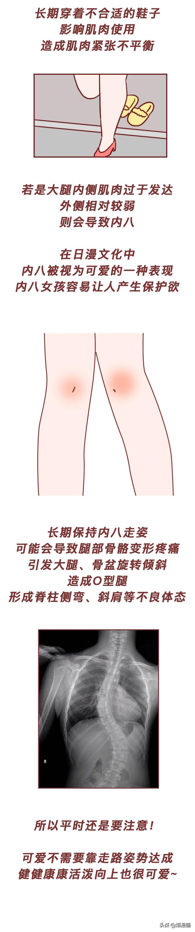 为什么有些女生喜欢夹紧大腿走路?揭露这样走路的底层原因