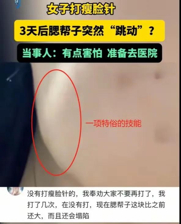 打瘦脸针获“腮帮舞”新技能?女子经历引热议