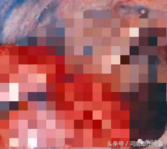 26岁妹子每天放屁50多次,送医后化验单吓到医生