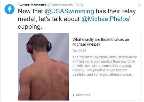 里约奥运会火了谁?宁泽涛被“袭胸”她因为“抖胸”被黄牌警告