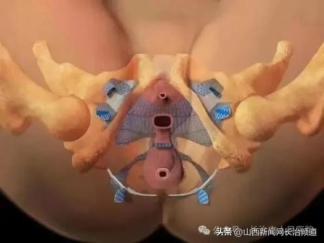 新突破!长治市人民医院妇科成功开展晋东南首例TVUS手术