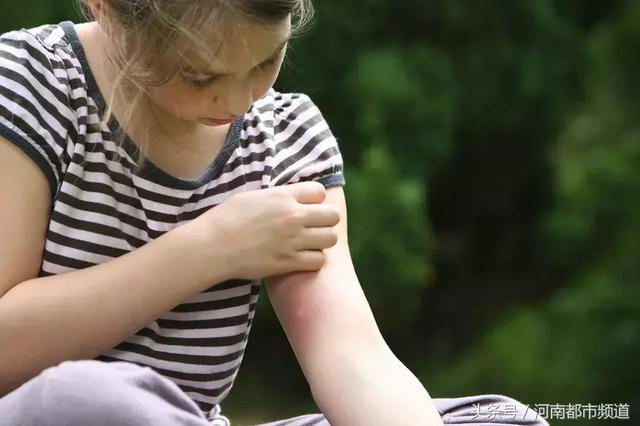 美女相亲归来,撩起裙子吓到崩溃:腿上几十个红疙瘩!