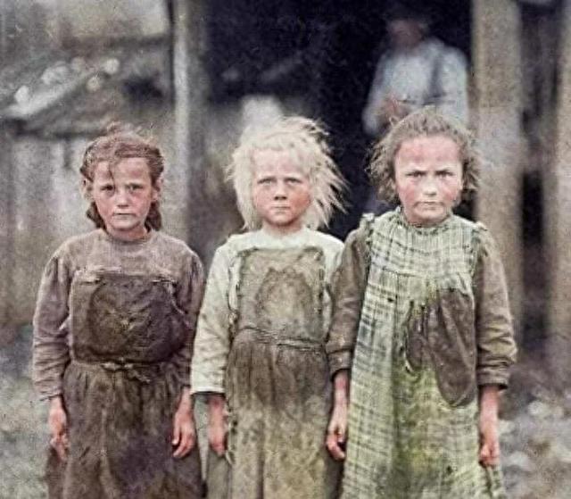 惊人发现!揭秘全球最大嘴巴女人,她竟有“牙齿”般的阴道