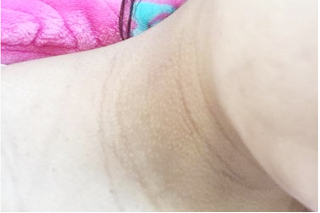 孕期这些部位黑到“怀疑人生”,孕妈别担心,这是娃发育好的表现