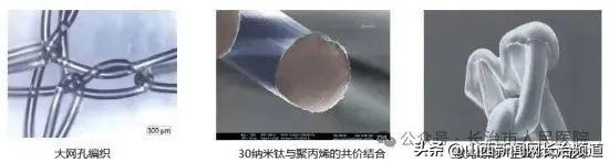 新突破!长治市人民医院妇科成功开展晋东南首例TVUS手术