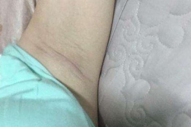 孕期这些部位黑到“怀疑人生”,孕妈别担心,这是娃发育好的表现