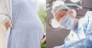 韩国一女性去堕胎，手术时竟传出胎儿啼哭声...
