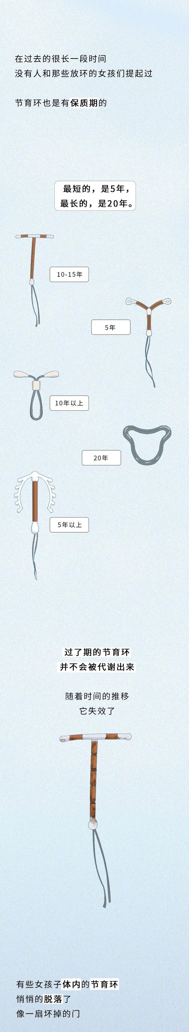 一张图告诉你“节育环”在女性体内的20年，没人能笑着看完