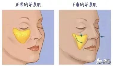 韩国顶级女星do脸，do成了张雨绮第二？也太恐怖了…