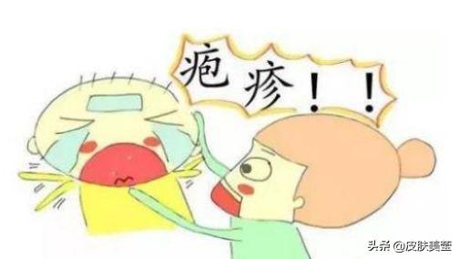 我认识的单纯疱疹病毒