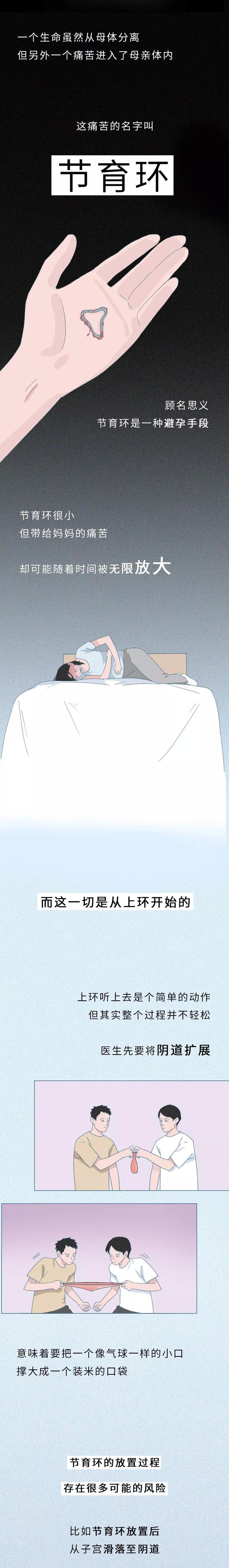 一张图告诉你“节育环”在女性体内的20年，没人能笑着看完