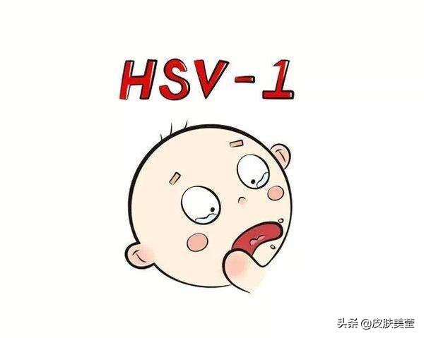 我认识的单纯疱疹病毒