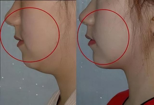 明明不胖却有烦人的双下巴?这个坏习惯连杨幂都中招了