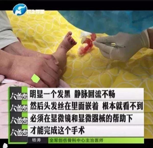 “紫砂掌”少年惊动多科室医学专家！几盆水洗黑，他居然好了