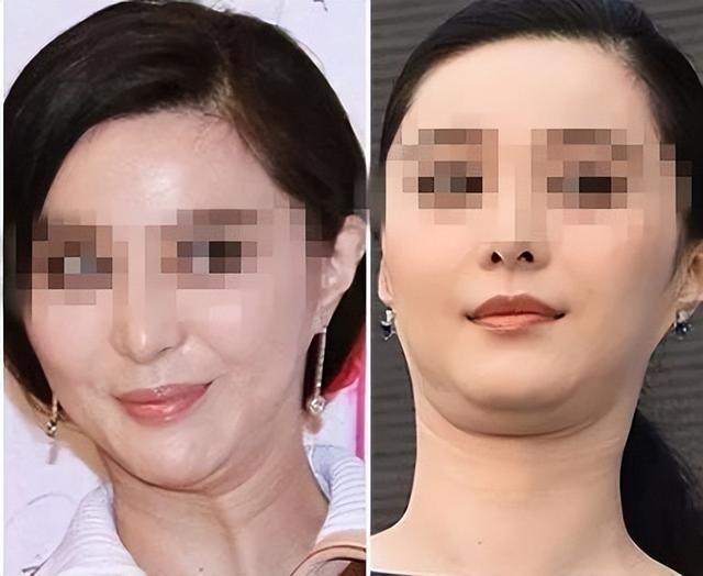 明明不胖却有烦人的双下巴?这个坏习惯连杨幂都中招了