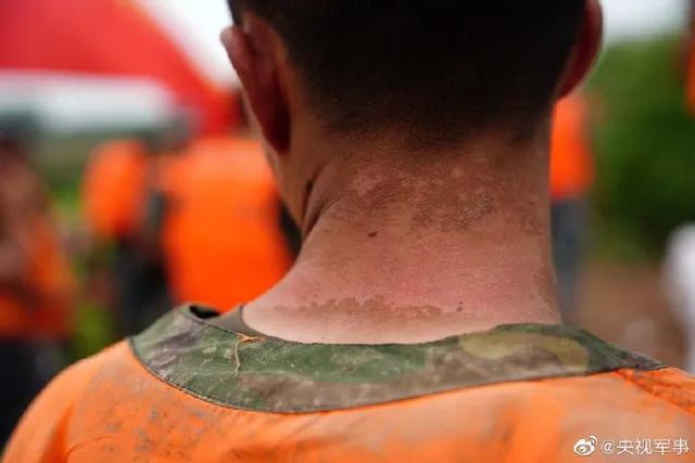 他们的“勋章”让人太心疼！幸好“应援团”来了