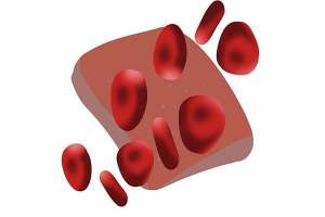 降低血脂(血脂高，如何降血脂？每天坚持走一万步，能降低血脂吗？)