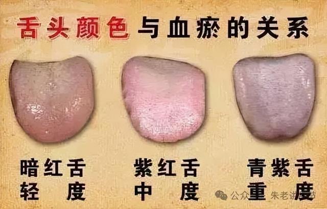 中医是怎么根据面色、舌苔，判断你有“病”的？
