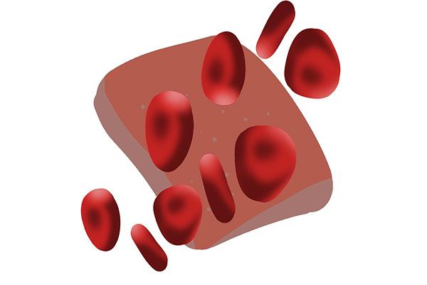 血脂高，如何降血脂？每天坚持走一万步，能降低血脂吗？