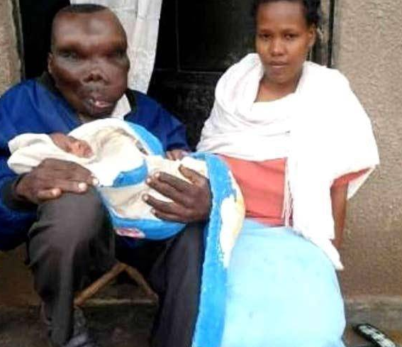 世界上面容最丑的男人!却成为了人生最好的赢家!