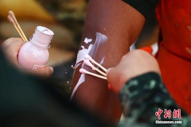 他们的“勋章”让人太心疼！幸好“应援团”来了