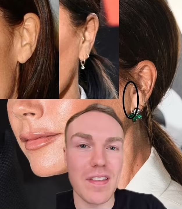 贝克汉姆50岁妻子“不老”容颜引专家质疑，“她做了整容手术”