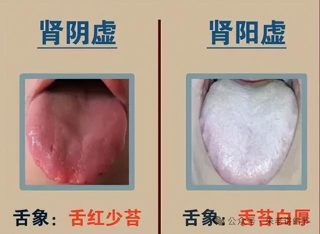 中医是怎么根据面色、舌苔，判断你有“病”的？