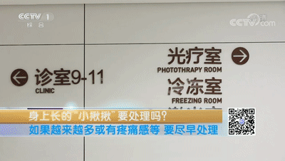 身上长的“小肉揪揪”预示感染了HPV病毒？专家解答来了