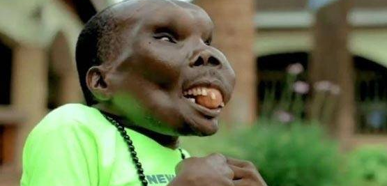 世界上面容最丑的男人!却成为了人生最好的赢家!