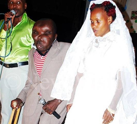 世界上面容最丑的男人!却成为了人生最好的赢家!