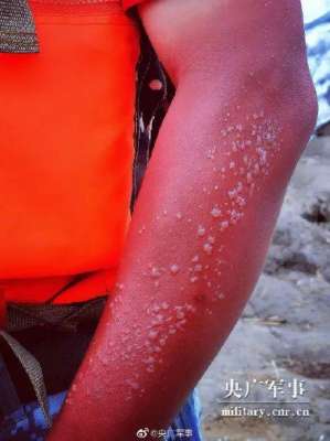 应援团(他们的“勋章”让人太心疼幸好“应援团”来了)