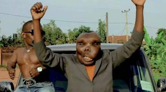 世界上面容最丑的男人!却成为了人生最好的赢家!