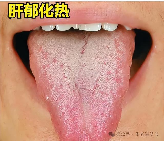 中医是怎么根据面色、舌苔，判断你有“病”的？