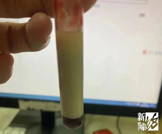 堪称“油王”!上海一男子突发剧烈腹痛,抽血抽出一袋油!罪魁祸首竟是它