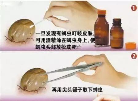 2岁娃眼皮上突然冒出一个小黑点！医生：这东西会要命！