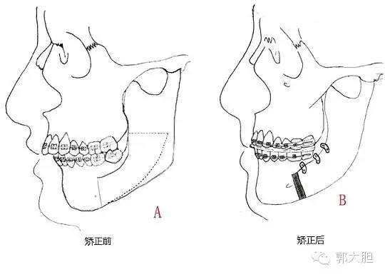 真实版整容日记！人生若只如初见，那时我还不好看