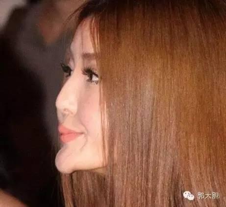 真实版整容日记！人生若只如初见，那时我还不好看