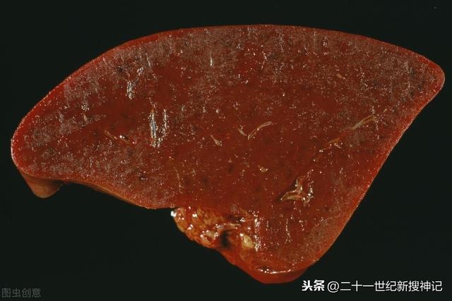 性命之谜（廿四）脾脏：五脏中的小透明，却有大名鼎鼎的神灵代表