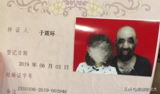 当年轰动一时的“毛孩”：42岁娶90后娇妻，生下一子未遗传长毛